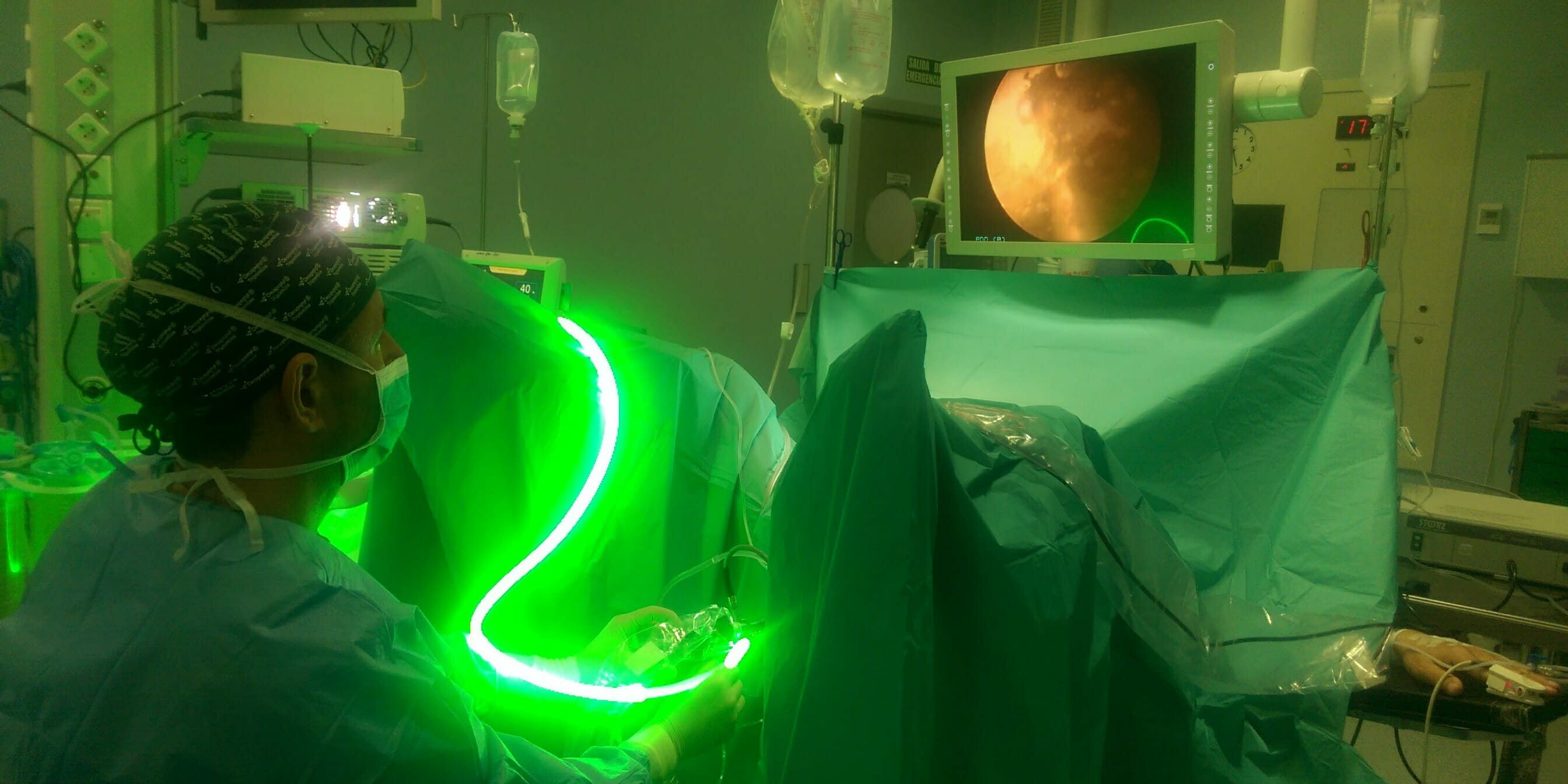 Laser en Urología