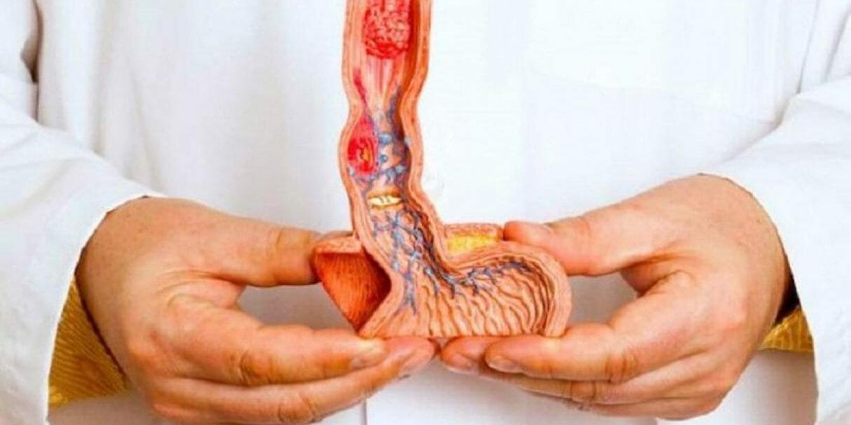 Cancer de próstata Urólogo en Granada