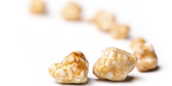 Litiasis renal y metabolismo